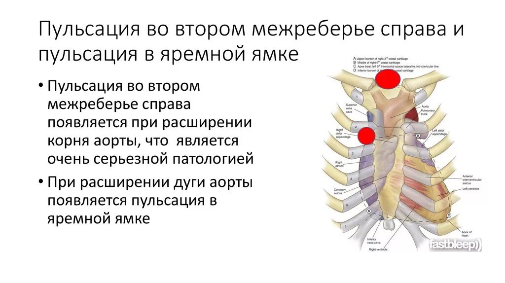 Сильно болит пульсирует. Пульсация в области яремной ямки. Пульсация в яремной ямке причины. Пульсация в яремной вырезке. Пульсация во втором межреберье.