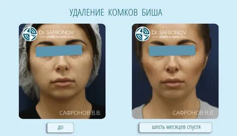 Функция комка биша