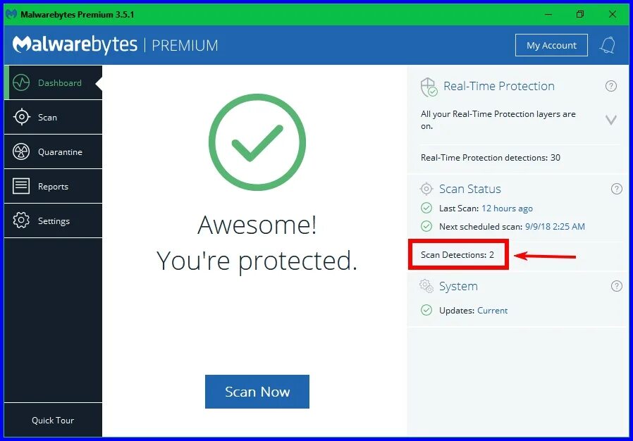 Malwarebytes uninstall. Сканер вирусов malwarebytes. malwarebytes как удалить. отчет malwarebytes. malwarebytes. удаление шпионских программ.