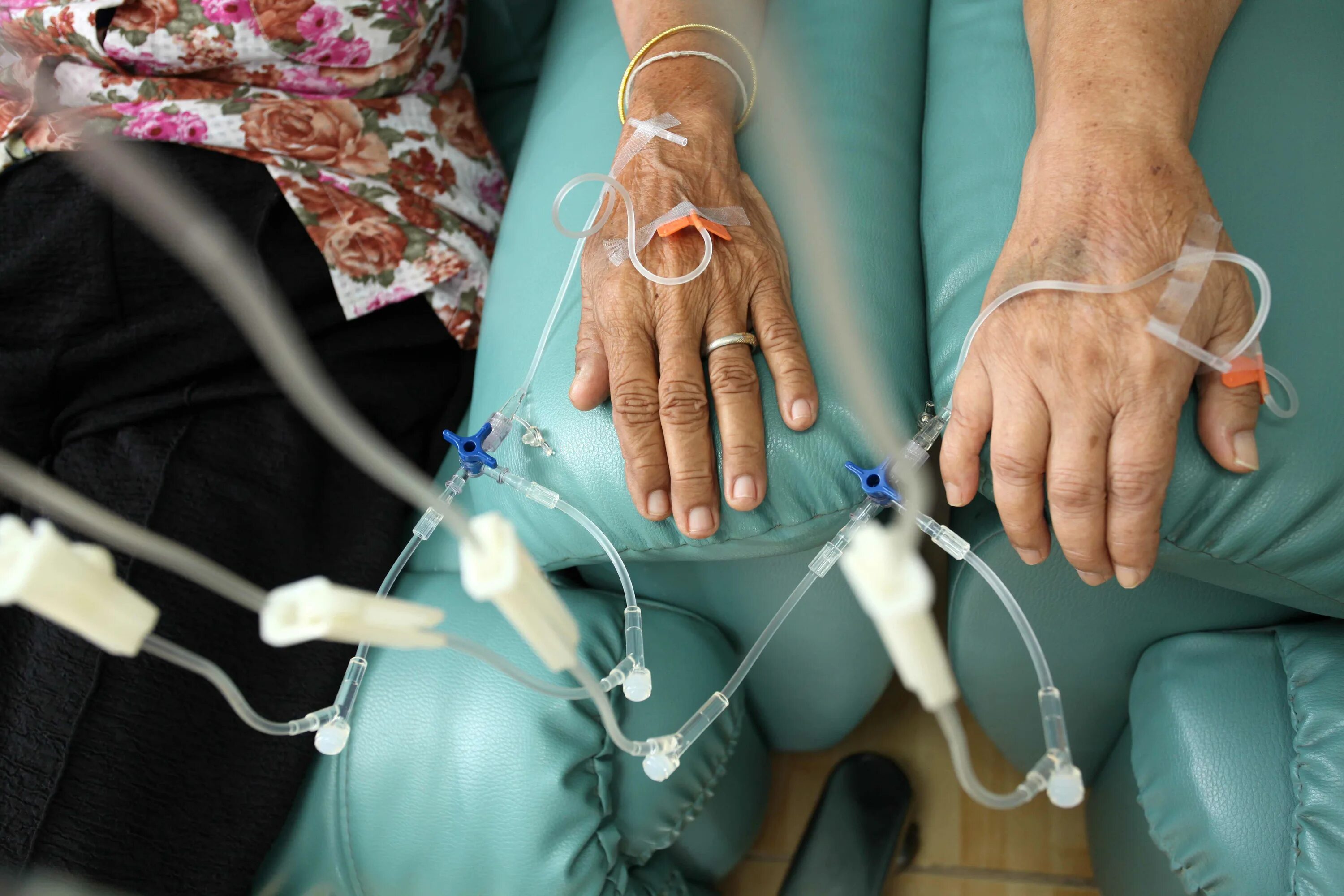 Химиотерапия при онкологии. Химиотерапия в онкологии. Two patients