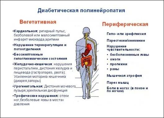 Полинейропатии нижних конечностей. Препараты от полинейропатии нижних конечностей. Лечение диабетической полинейропатии нижних конечностей. Алкогольная полинейропатия нижних конечностей.