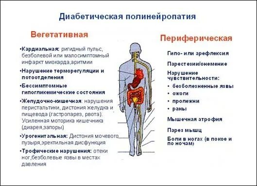 Народное лечение полинейропатии нижних конечностей. Полинейропатии нижних конечностей. Препараты от полинейропатии нижних конечностей. Лечение диабетической полинейропатии нижних конечностей. Алкогольная полинейропатия нижних конечностей.