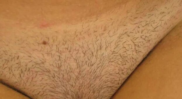 Дисгидротическая экзема. Вплоть широкий. Костюм 19 века женский доклад. Школы при монастырях в древней руси. Вплоть широкий.