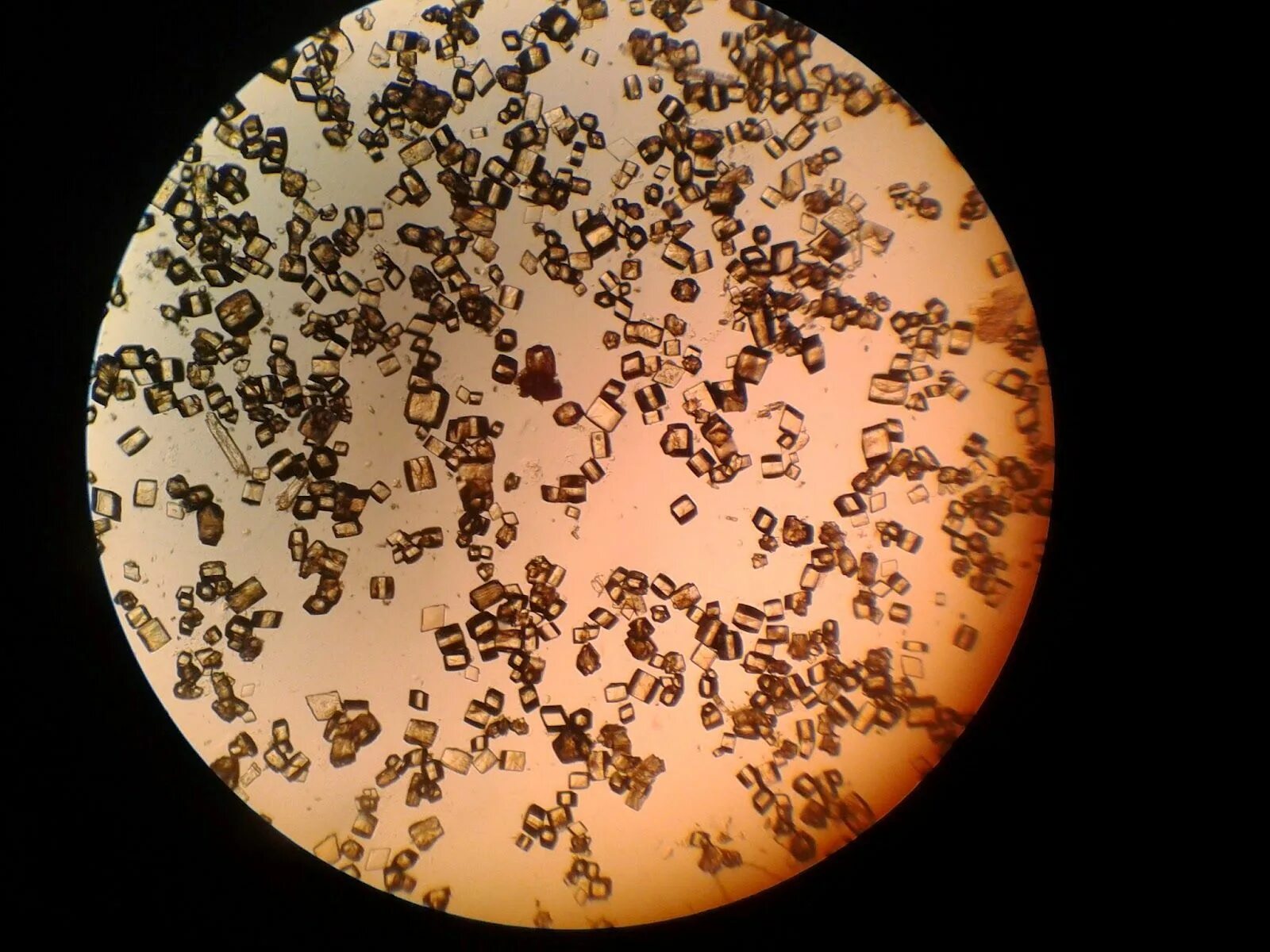 Иглы в моче. Оксалаты микроскопия мочи. Соли в моче микроскопия Ураты. Мочевая кислота микроскопия мочи. Микроскопия мочи соли мочевой кислоты.
