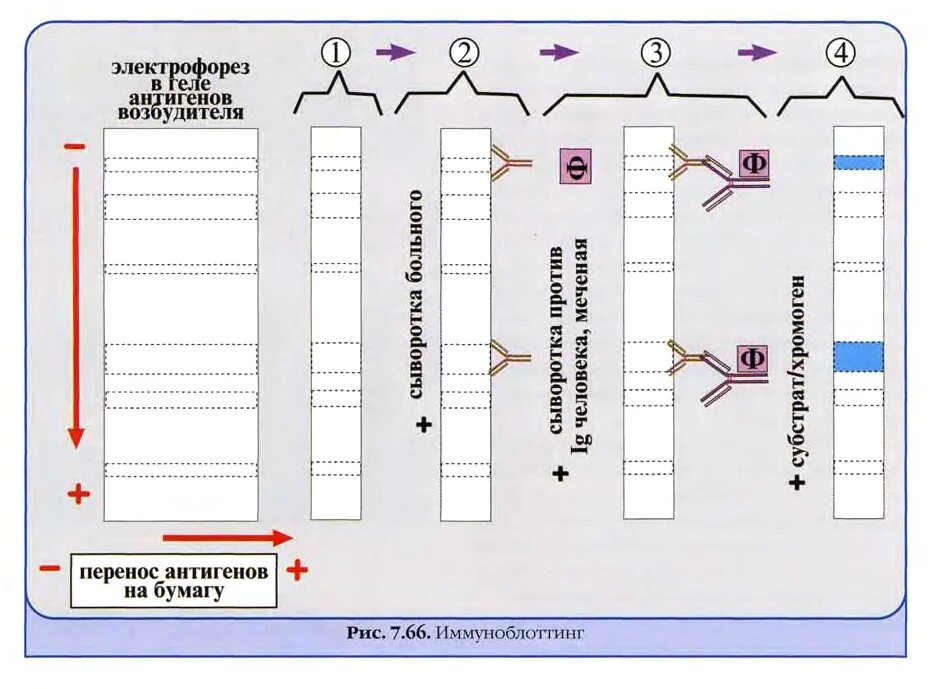 Иммунный блоттинг. Иммуноблоттинг компоненты реакции. Иммуноблоттинг микробиология схема. Иммуноблоттинг микробиология механизм. Вестерн блоттинг (иммуноблоттинг) механизм реакции.