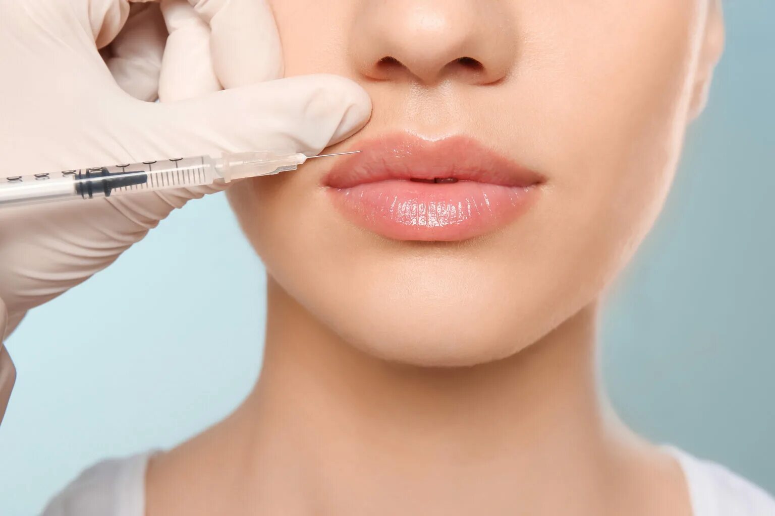 Lip filler