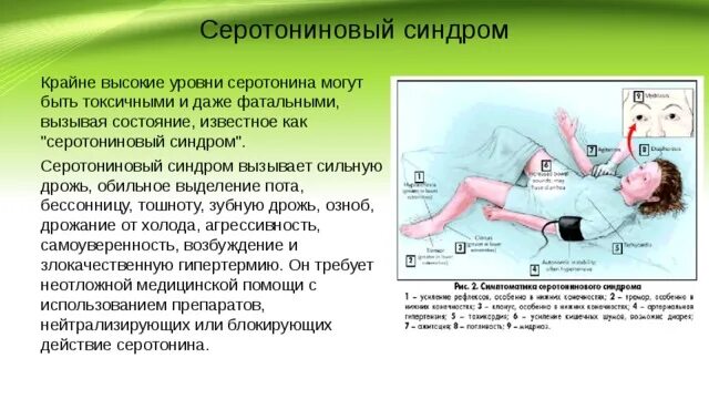 Серотонинового синдрома. Симптомы серотонинового синдрома. Серотонин яма. Серотониновый криз