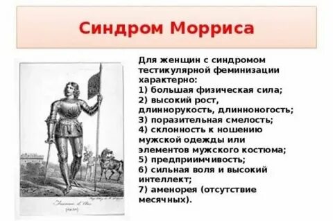Синдром морриса у женщин