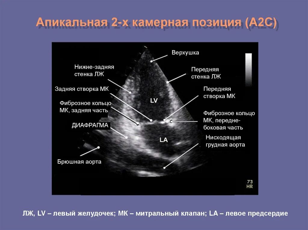 Апикальный 4 камерный доступ. ЭХОКГ В 4 камерной позиции. Апикальная позиция ЭХОКГ. Двухмерная эхокардиография. Эхо кс цена