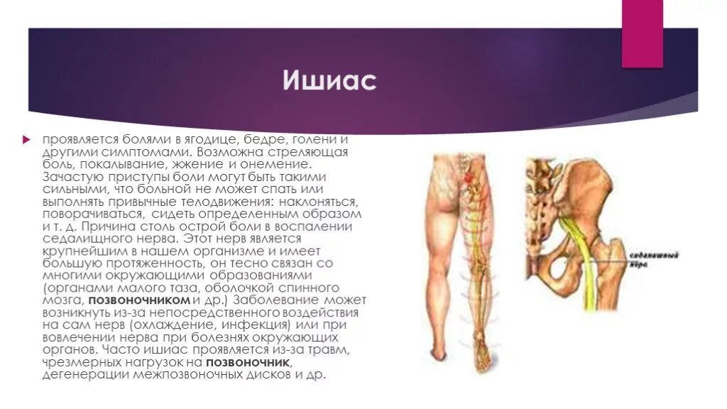Боль в бедре диагноз. Седалищный нерв в ягодице. Поражение седалищного нерва симптомы. Седалищный нерв боль в ягодице. Ишиас седалищного нерва.