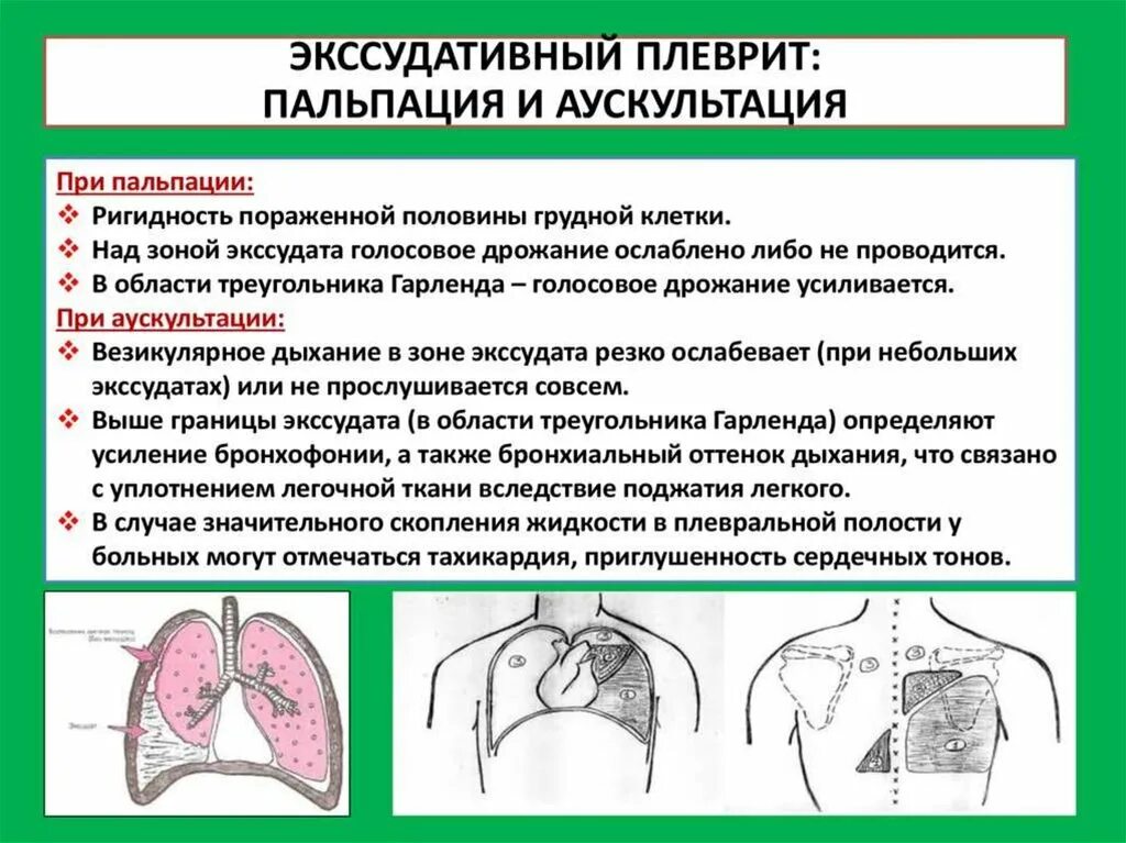 Появление экссудата характерно для