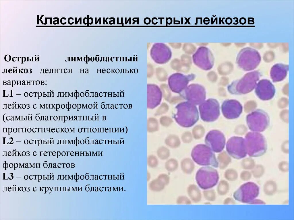 Острый лимфобластный лейкоз l1. Острый лимфобластный лейкоз миелограмма. Острый лимфобластный лейкоз l2 картинки. Миелобластный лейкоз и лимфобластный лейкоз. Лейкоз характеризуется