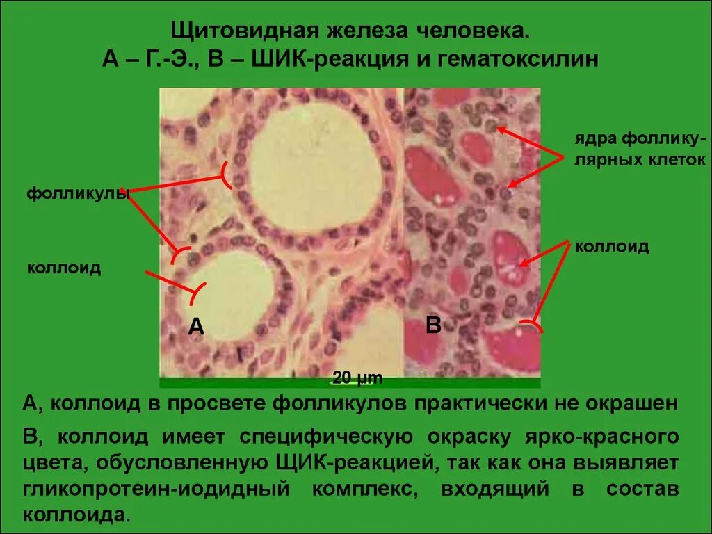 Фолликул щитовидной железы что это. Коллоид щитовидной железы. Коллоид в щитовидной желез. Тироциты щитовидной железы. Щитовидная железа гематоксилин.