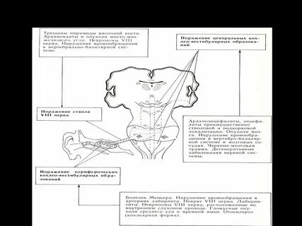 Симптомы лечения вестибулярного аппарата
