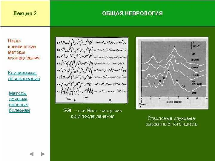 Кома ээг. Вызванный потенциал ээг. ээг при заболеваниях. ээг при коме. слуховые вызванные потенциалы.