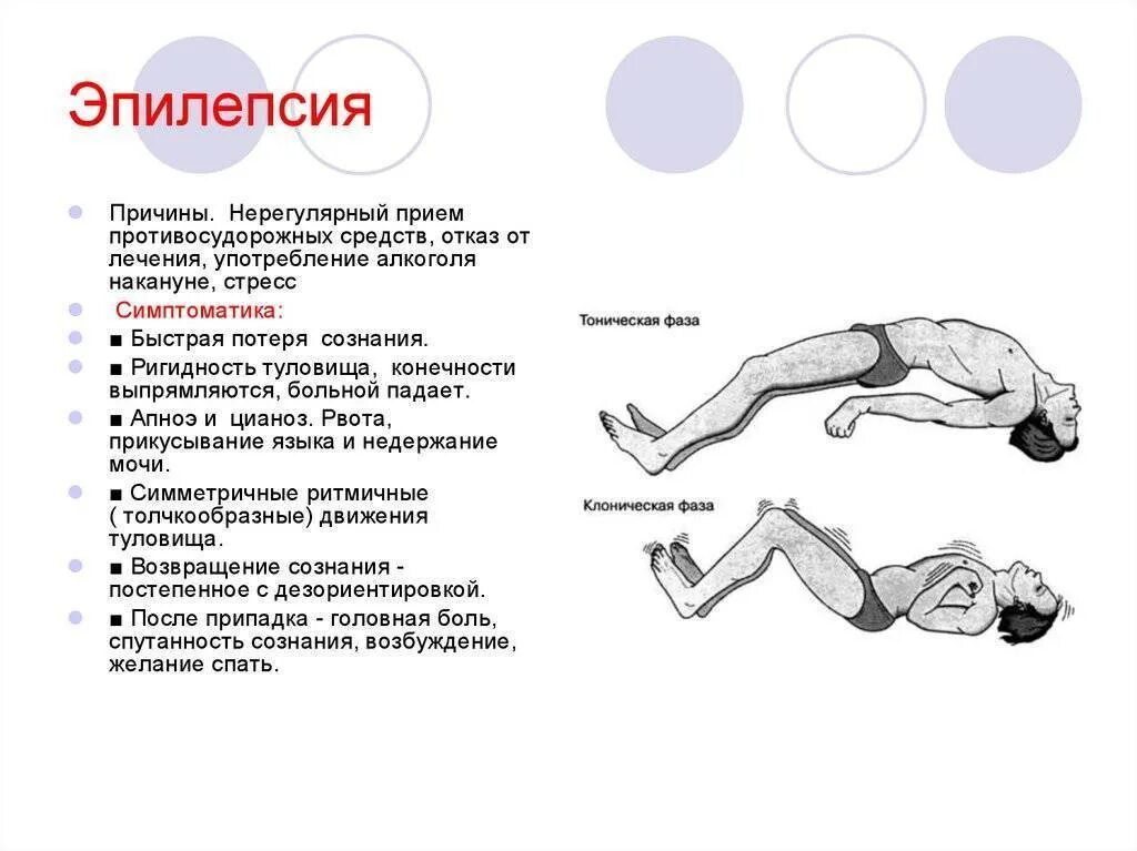 Эпилепсия ночью