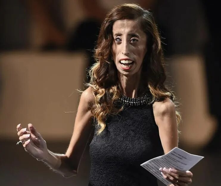 1 в мире женщина в открытом. Лиззи Веласкес Lizzie Velasquez.