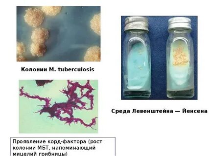 Метод обнаружения микобактерий туберкулеза