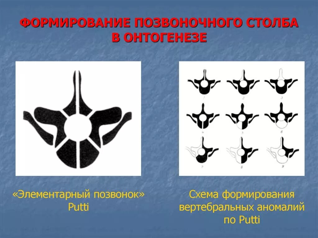 Аномалии развития позвонков. Аномалии развития тел позвонков. Аномалии позвоночного столба анатомия. Аномалии переходных отделов позвоночного столба.