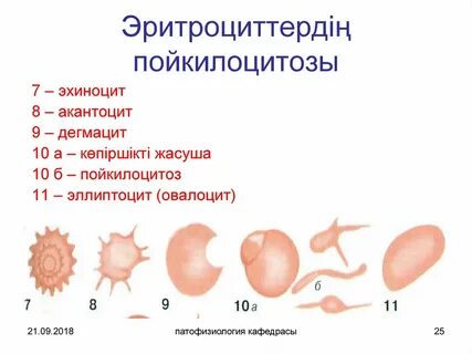 Пойкилоцитоз это состояние при котором эритроциты