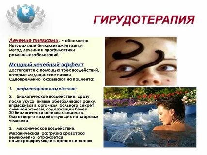 Лечебный эффект гирудотерапии выражен в тест