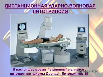 Дистанционная литотрипсия