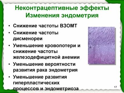Вторичная дисменорея