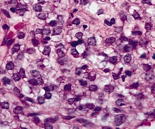 Липосаркома у собаки как выглядит Lipoma nel cane e nel gatto! Può dare problemi Amica Veterinaria