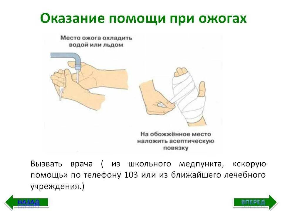 Помощь при ожоге заключается в следующем