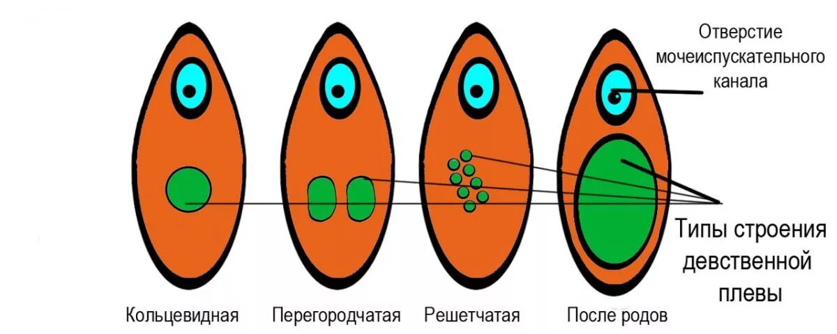 Zarimon где можно купить россии. Фрукт похожий на женский половой орган. Тампон и девственная плева. Анатомия девственной плевы. Разновидности форм девственной плевы.