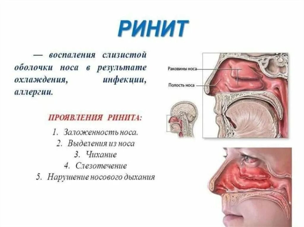 Почему не проходит заложенность