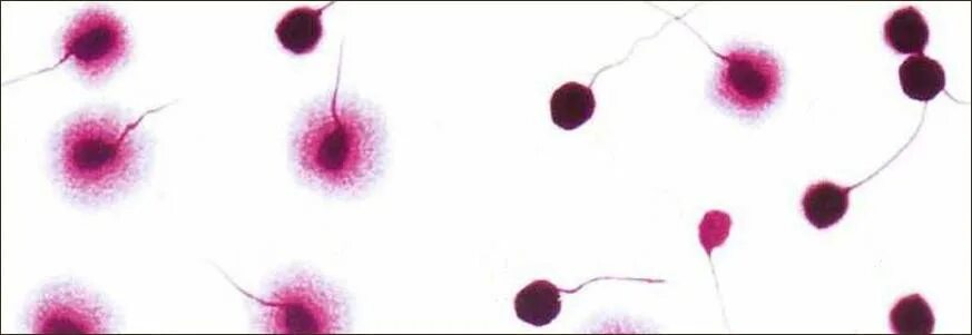 Фрагментация днк методы. Фрагментация сперматозоидов 17. ДНК фрагментацию Halosperm. Фрагментация ДНК методом tunel. Фрагментация ДНК сперматозоидов 25.
