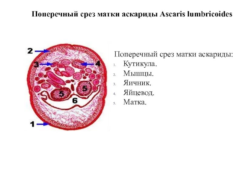 Кутикула аскариды. Поперечный срез самки аскариды. поперечный срез аскариды человеческой. препарат: поперечный срез ascaris lumbricoides. поперечный срез аскариды человеческой препарат.