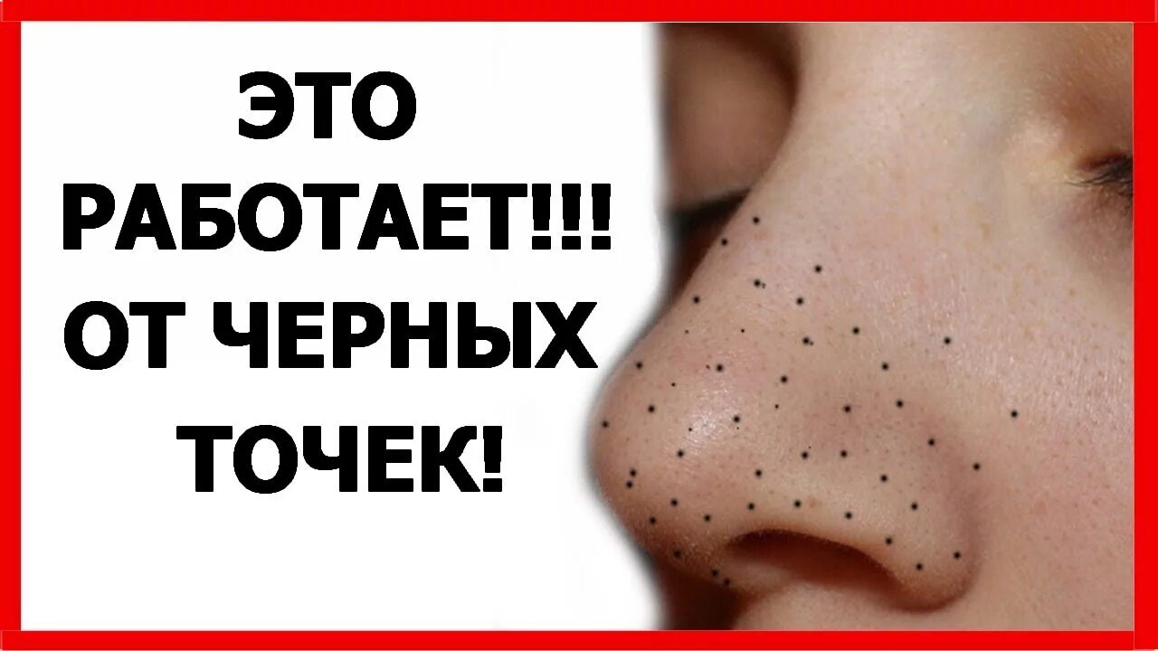 Избавление от чёрных точек. Избавиться от черных точек. Как избавиться от пятна черного. Избавиться от черных точек. Как избавиться от пятна черного.