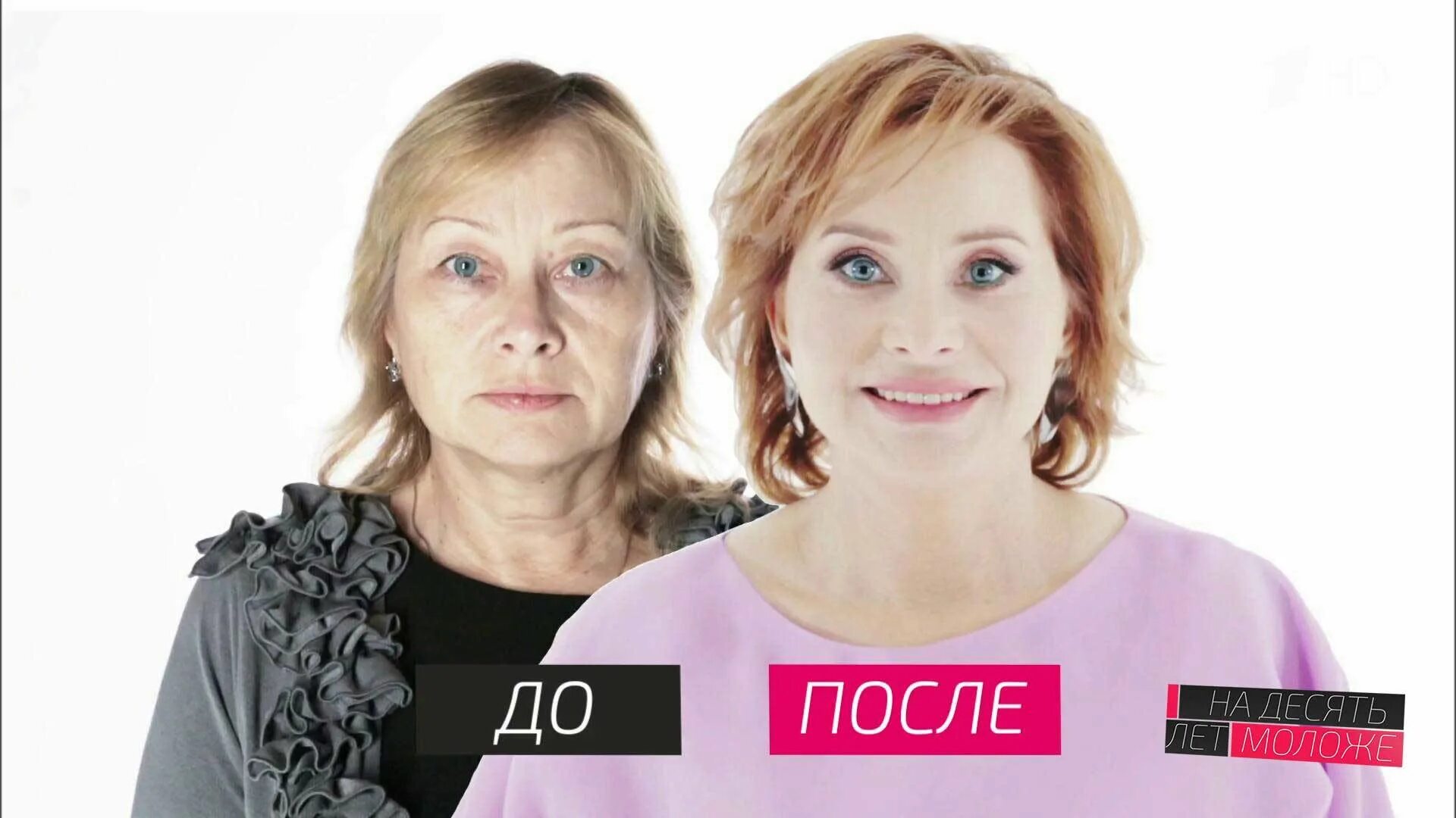 На несколько лет моложе. На 10 лет моложе моложе стоматолог олег конников. рена на 10 лет моложе. проект на 10 лет моложе. преображение на 10 лет моложе.