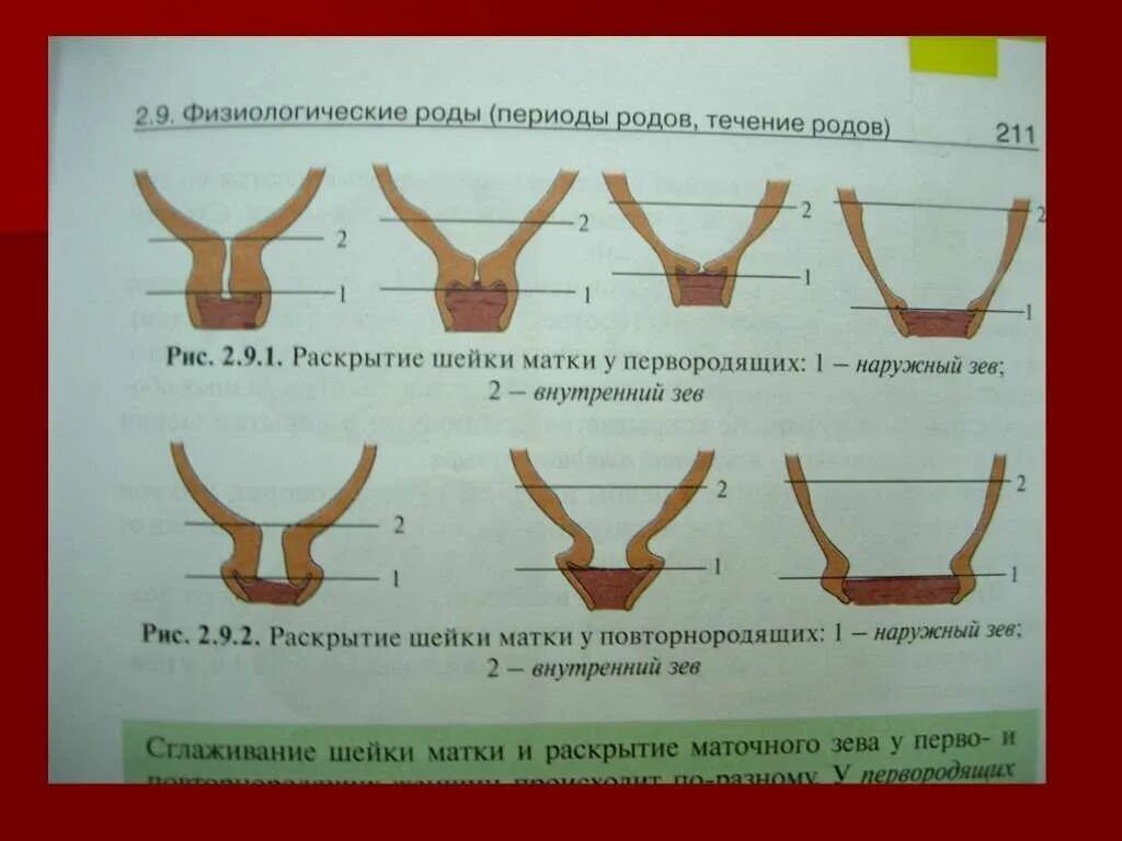 На сколько пальцев родах. Раскрытие шейки матки перед родами. Шейка матки перед родами.