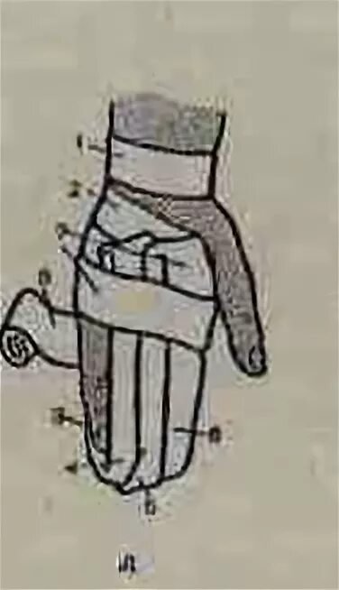 Техника наложения варежки