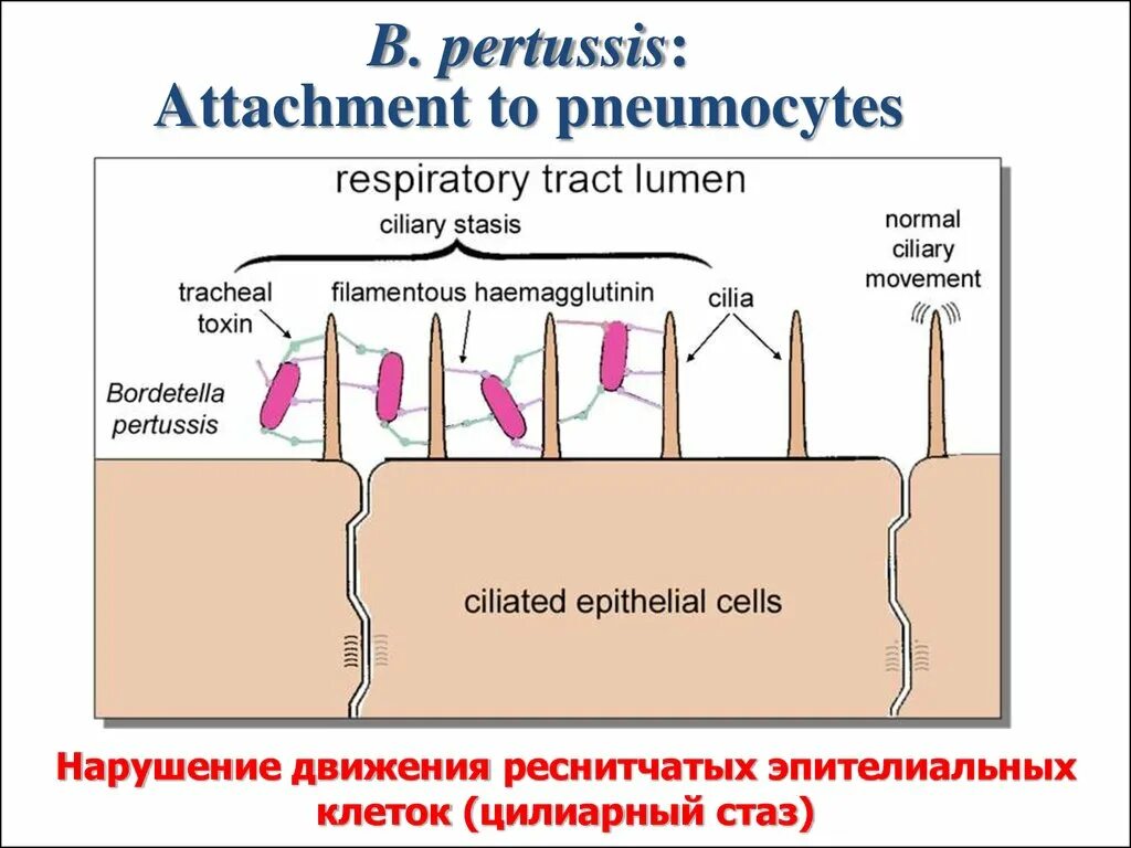 Pertussis коклюш. Бордетелла пертуссис. Бордетелла пертуссис микробиология. Бордетелла пертуссис антигенная структура. Бордетелла пертуссис строение.