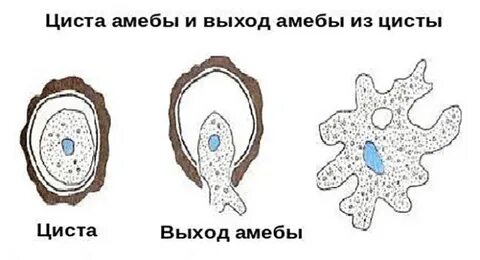 Циста