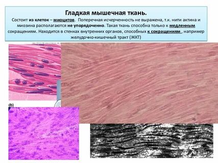 Мышечная ткань поперечная исчерченность