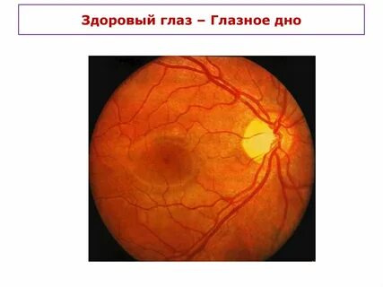 Глазном дне норма