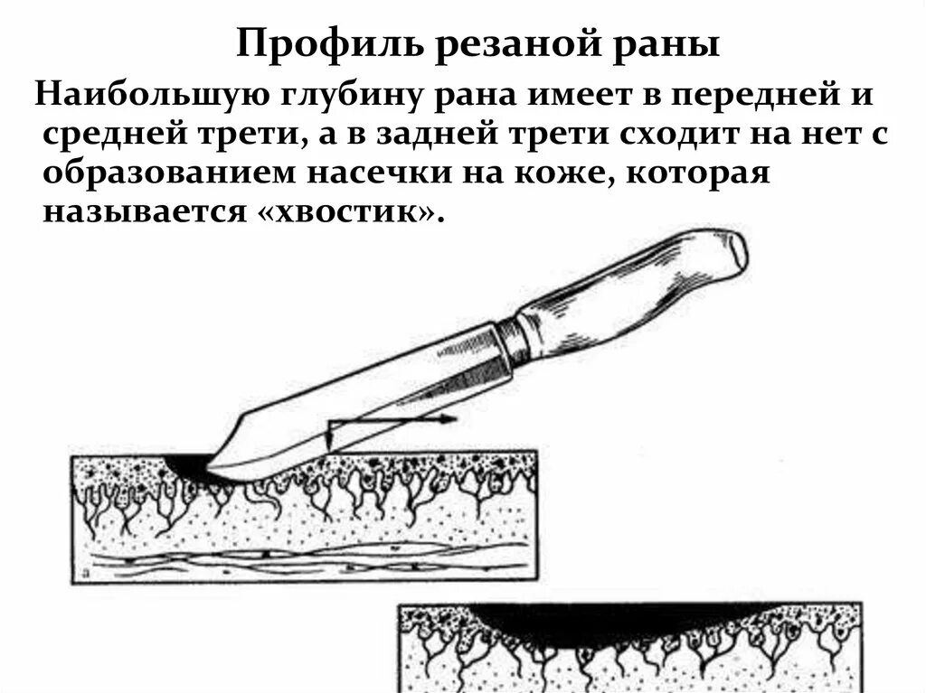 Повреждение причиненное ударом. Механизм образования резаной раны. Пхо колото резаной раны. Резаная рана судебная медицина. Судебно-медицинская экспертиза повреждений острыми предметами.