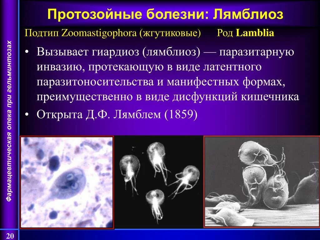 Протозойные инфекции. Протозойные инфекции лямблиоз.