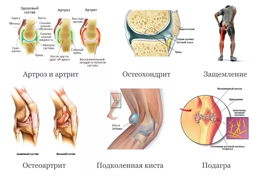 Колено им казалось что