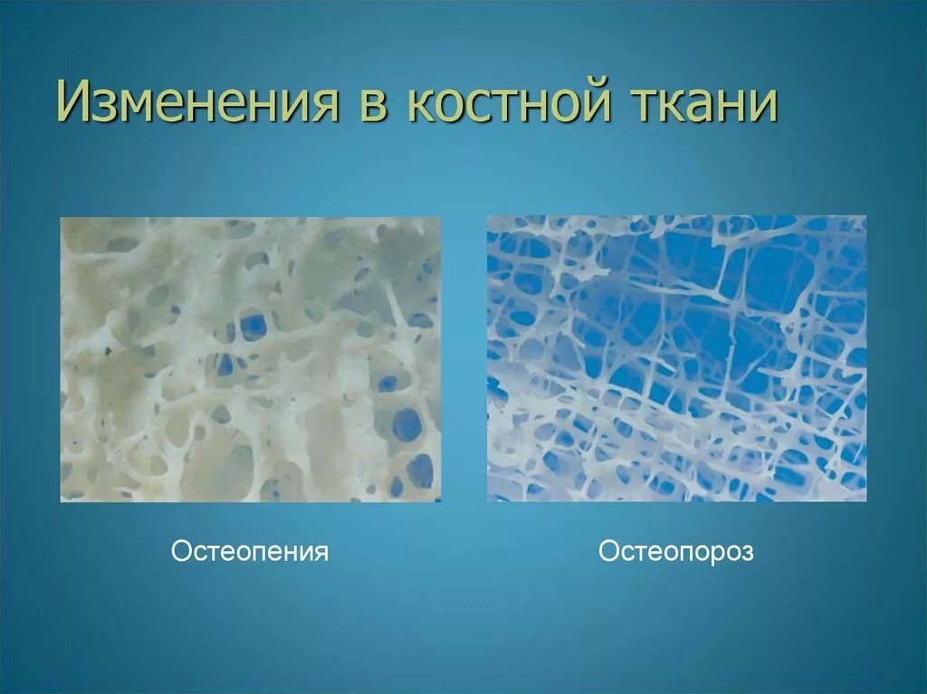 Пластинчатая костная ткань. Пластинчатая костная ткань остеон гистология. Остеогенные клетки периоста функции. Кальций в костной ткани. Остеогенные клетки.