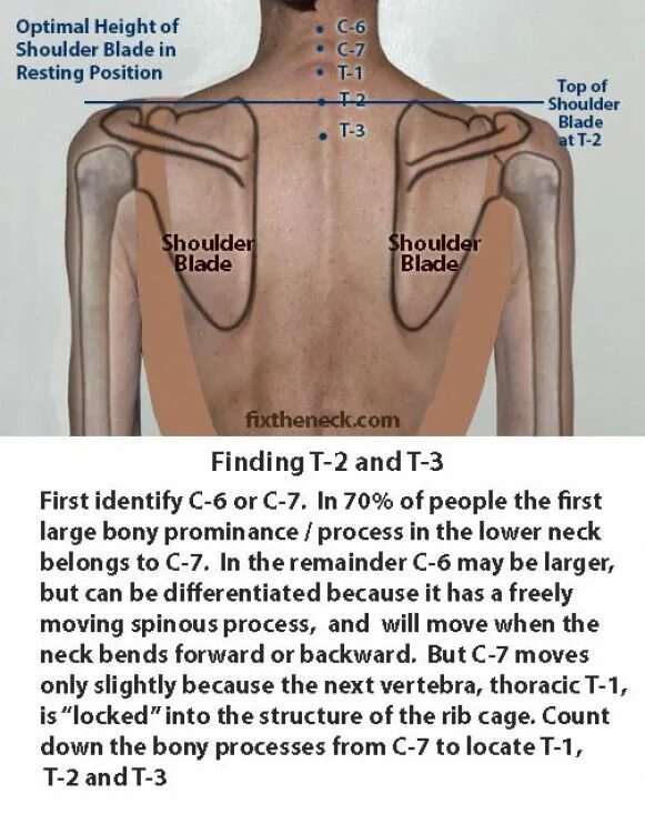 Back between. Neck Shoulder Top картинка. Shoulder Blade. Neck Pain postures. Head, Neck Shoulder, and back Pain.