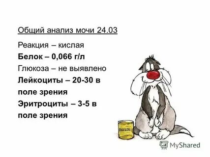 Белок в моче 0 150