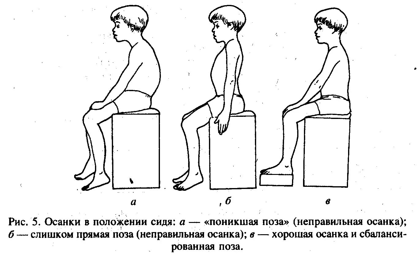 Правильная и неправильная осанка. Правильная осанка стоя и сидя. Неправильное положение сидя. Как правильно. Ровная спина.