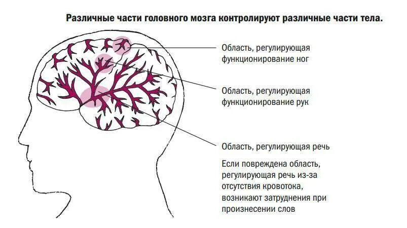 Лечение головного мозга форум. Ишемический инсульт поражения артерий. при поражении правого полушария головного мозга. пораженные участки мозга.