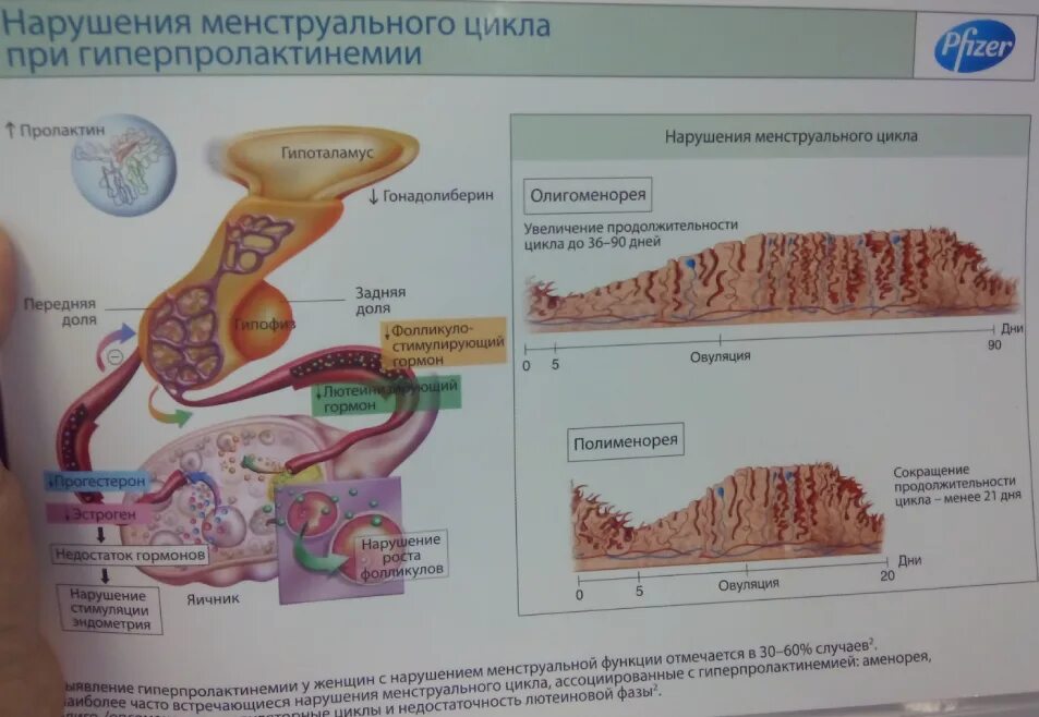 Либидо цикл. Нарушение менструального цикла. Менструальный цикл схема.